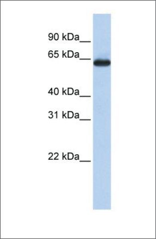 Anti-SLC34A3 antibody produced in rabbit