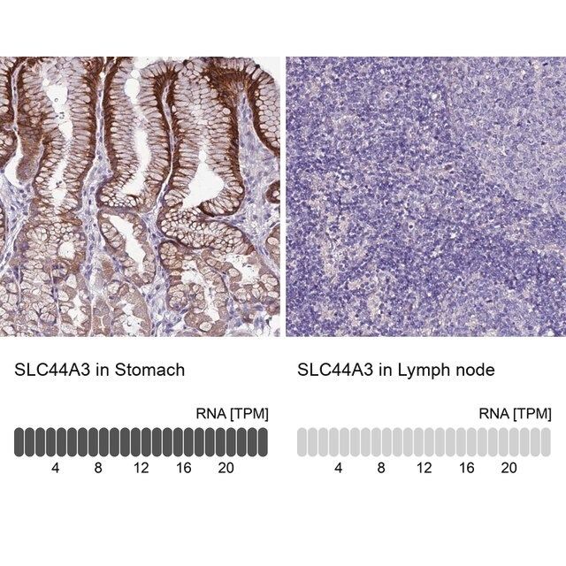 Anti-SLC44A3 antibody produced in rabbit