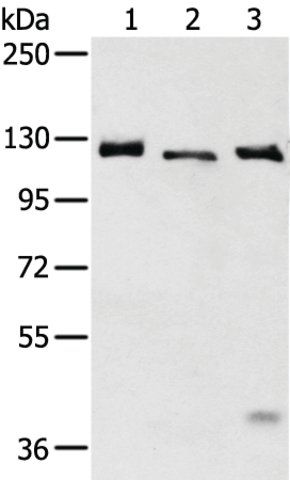 Anti-SLC4A3