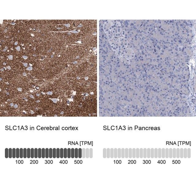 Anti-SLC1A3 antibody produced in rabbit