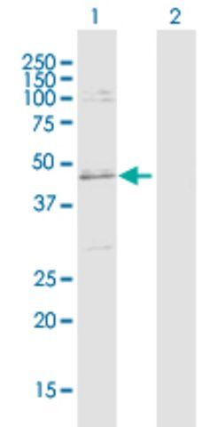 Anti-SLC25A31 antibody produced in rabbit