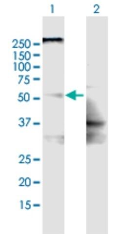 Anti-SLC22A8 antibody produced in mouse