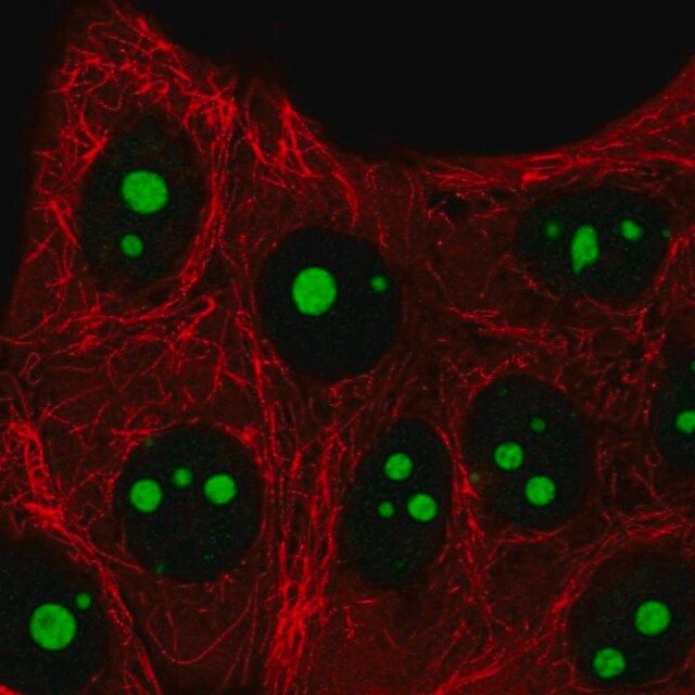 Anti-SETMAR antibody produced in rabbit