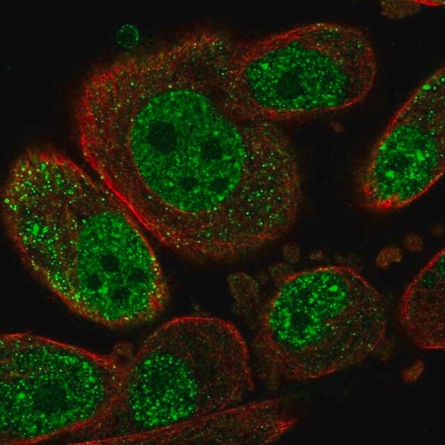 Anti-SETD6 antibody produced in rabbit