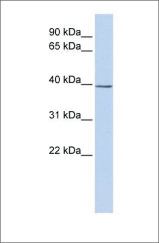 Anti-SETD3 antibody produced in rabbit