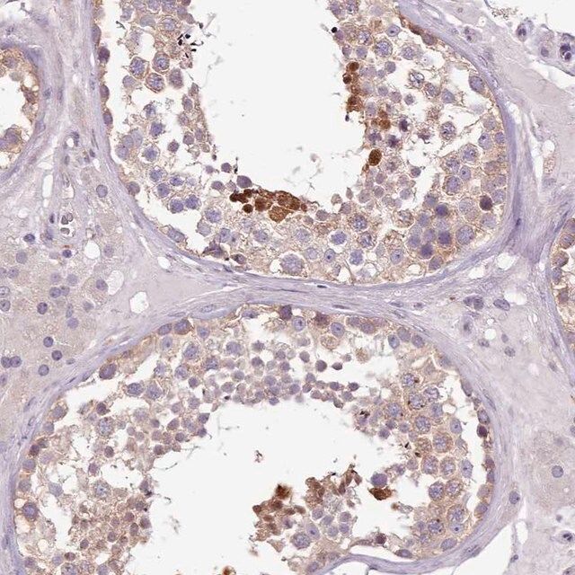 Anti-SETX antibody produced in rabbit