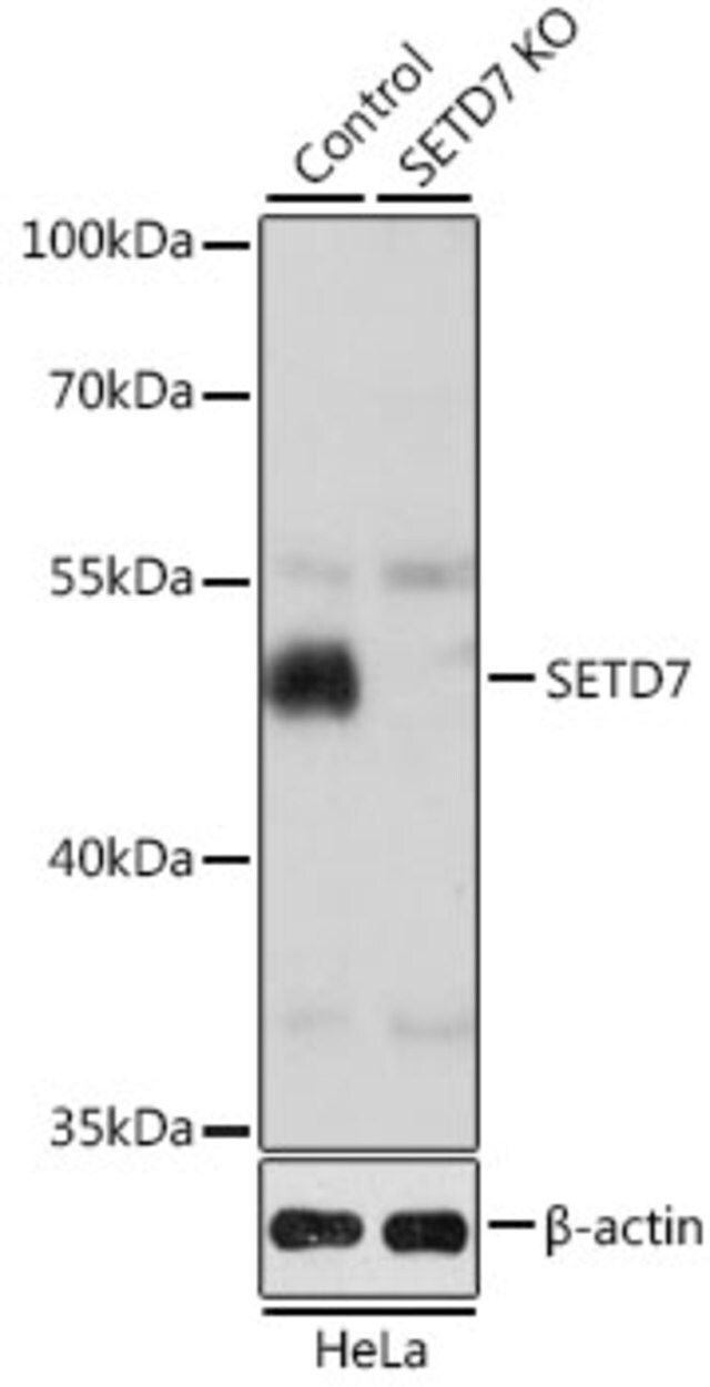 Anti-SETD7 antibody produced in rabbit