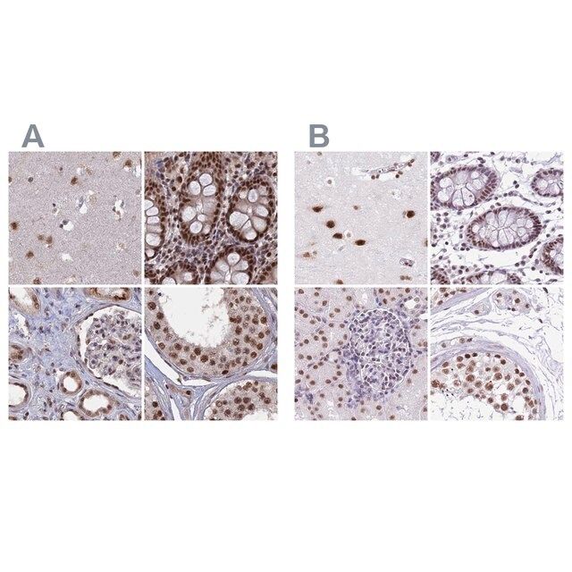 Anti-SF3A2 antibody produced in rabbit