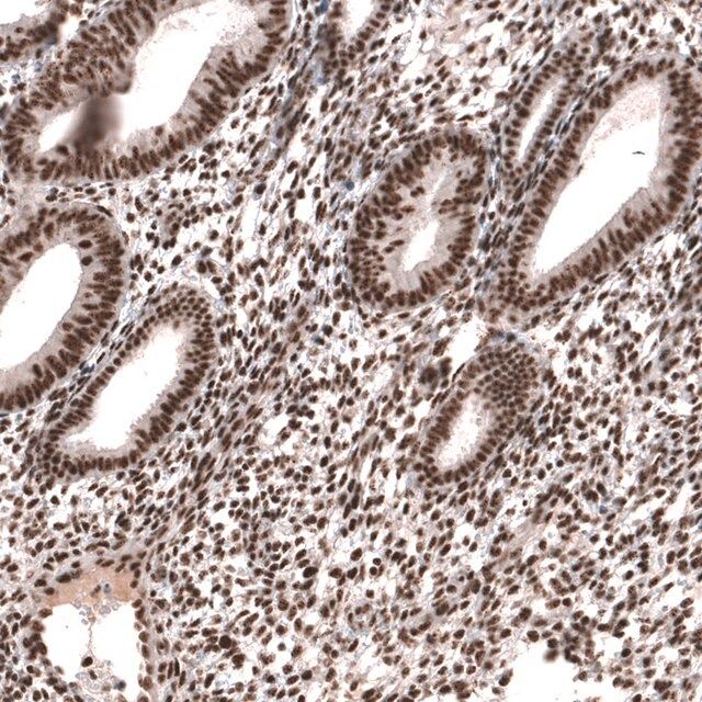 Anti-SETD2 antibody produced in rabbit