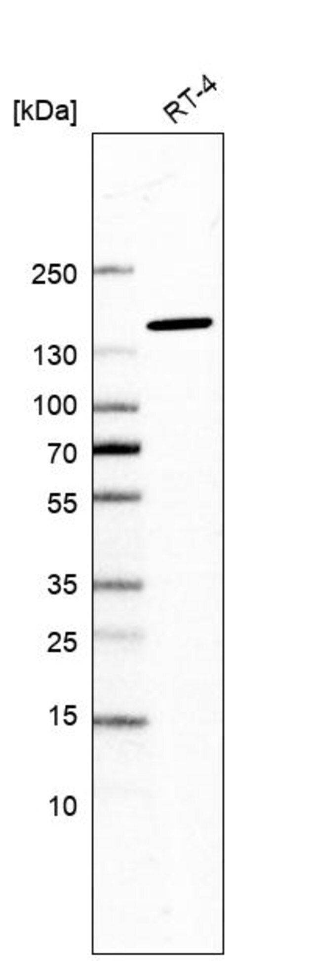 Anti-SF3B1 antibody produced in rabbit