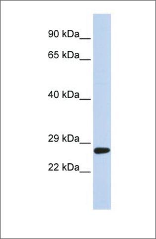 Anti-SETD4 antibody produced in rabbit