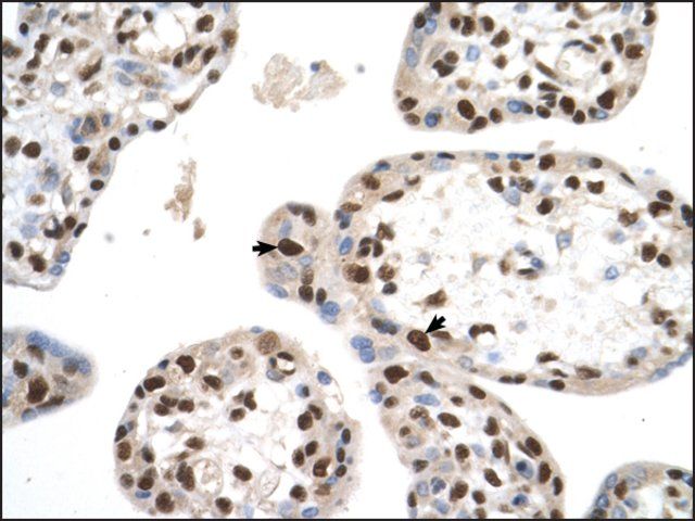 Anti-SETD2 antibody produced in rabbit