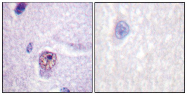 Anti-SF1, N-Terminal antibody produced in rabbit