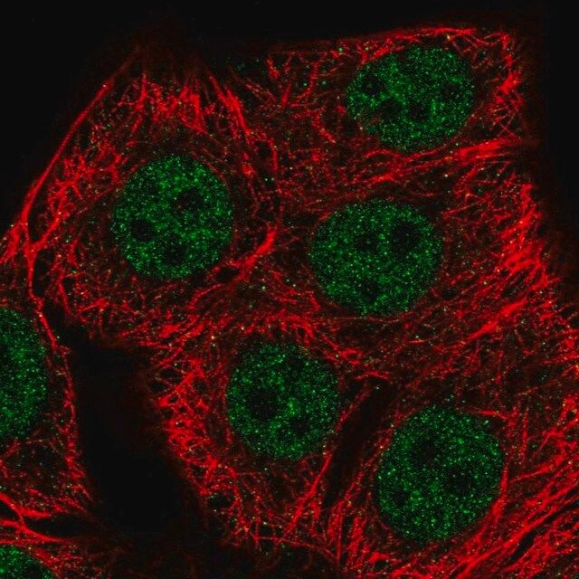 Anti-SETD1B antibody produced in rabbit