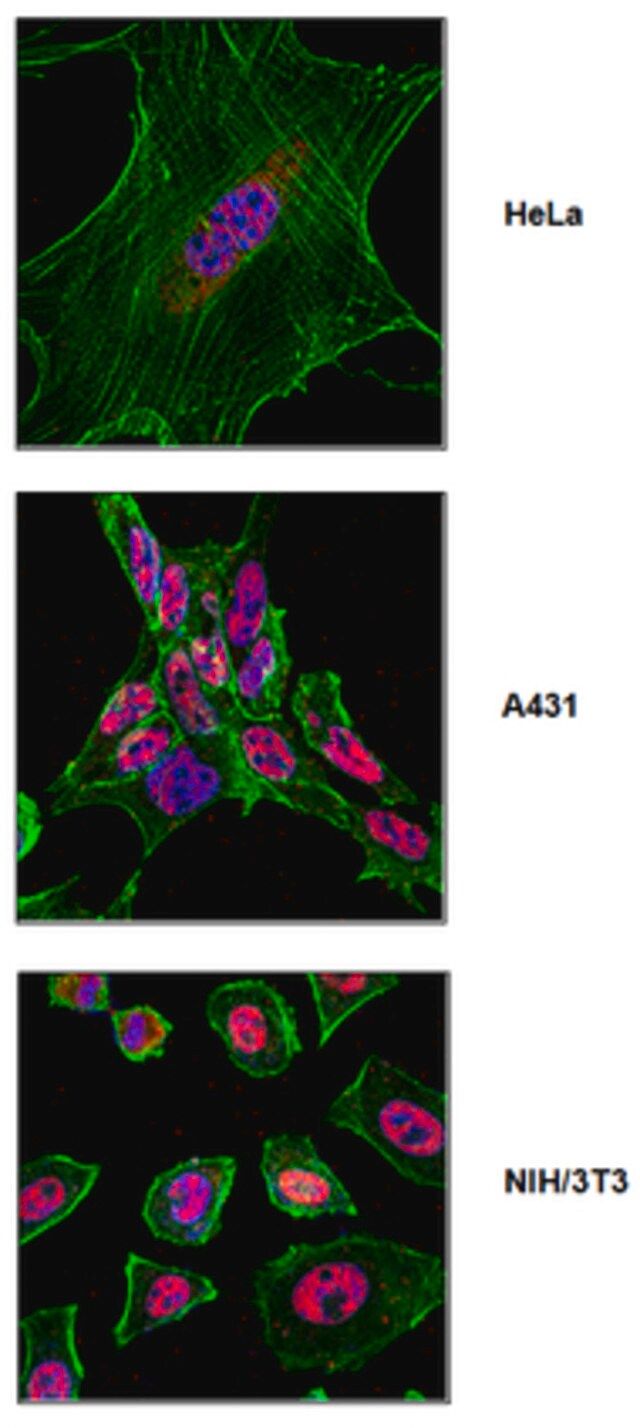 Anti-SF3b155 (SAP 155) Antibody