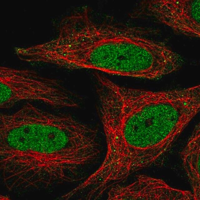 Anti-SFMBT1 antibody produced in rabbit