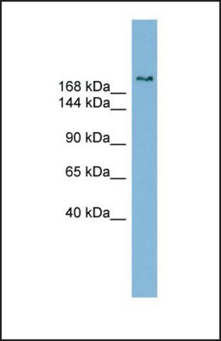 Anti-SETBP1 antibody produced in rabbit