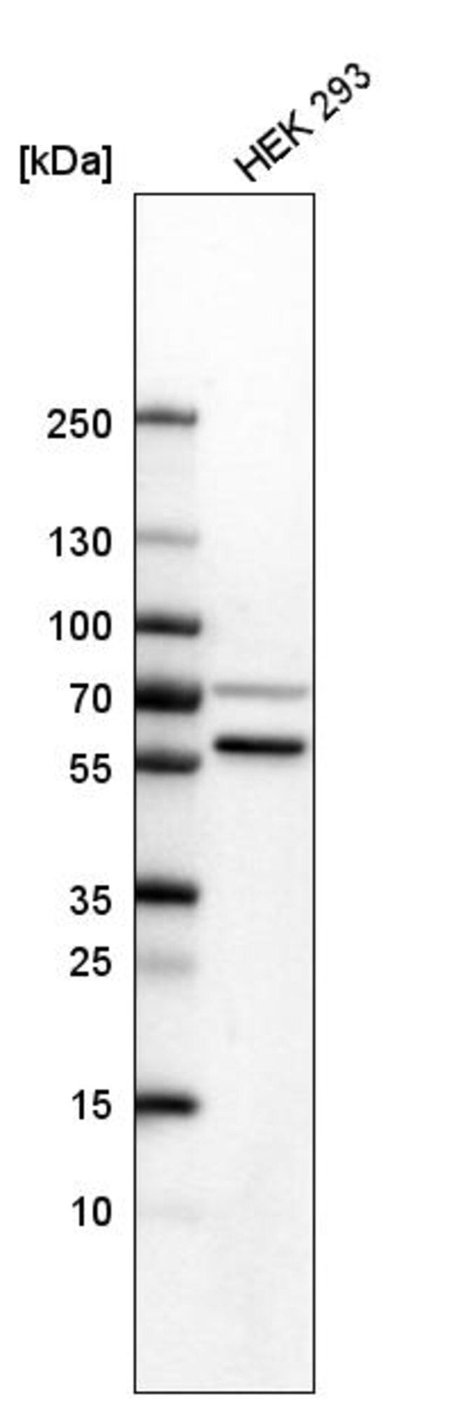 Anti-SETD6 antibody produced in rabbit