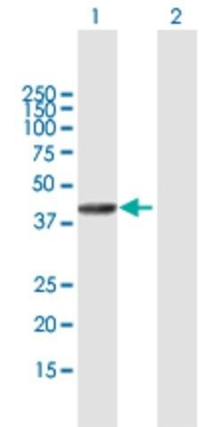 Anti-SETMAR antibody produced in mouse