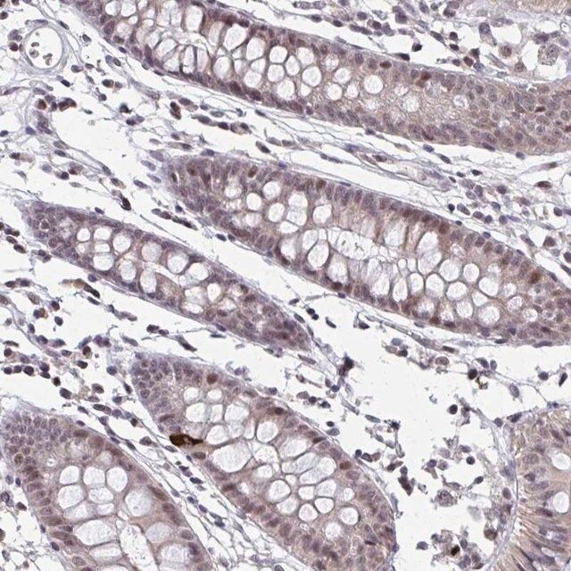 Anti-SETBP1 antibody produced in rabbit