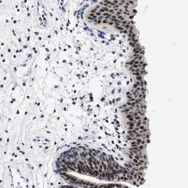 Anti-SETD1B antibody produced in rabbit