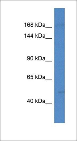 Anti-SETD5 antibody produced in rabbit