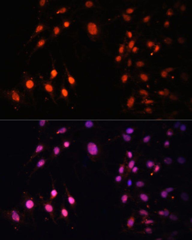 Anti-SETD2 antibody produced in rabbit