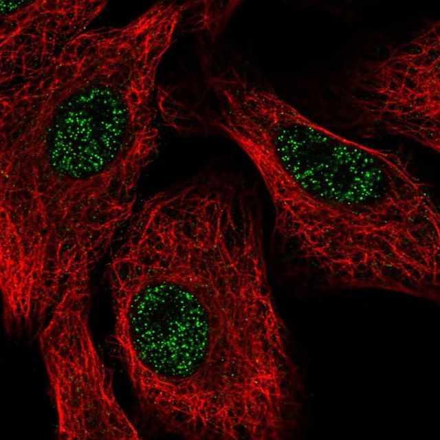 Anti-SETX antibody produced in rabbit