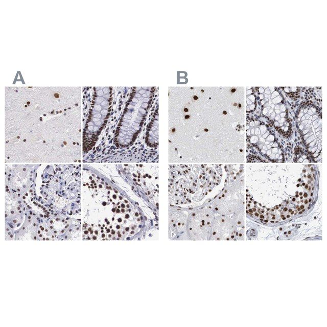 Anti-SF3A1 antibody produced in rabbit