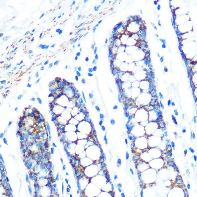 Anti-SFRP4 antibody produced in rabbit