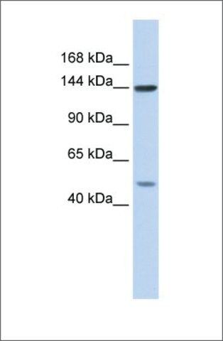 Anti-SF3B1