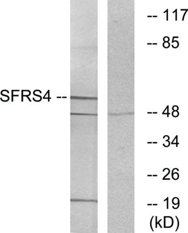 Anti-SFRS4 antibody produced in rabbit