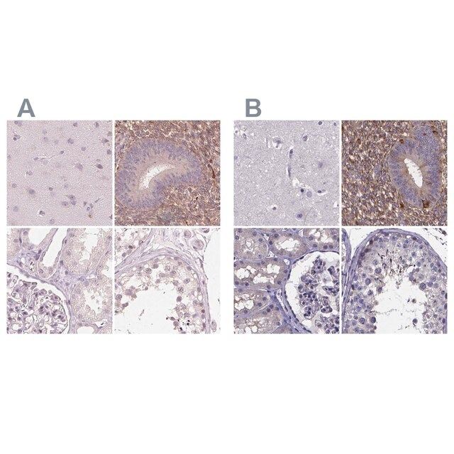 Anti-SFRP4 antibody produced in rabbit