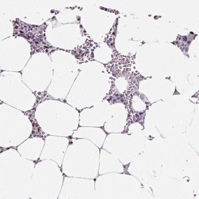 Anti-SF3B5 antibody produced in rabbit