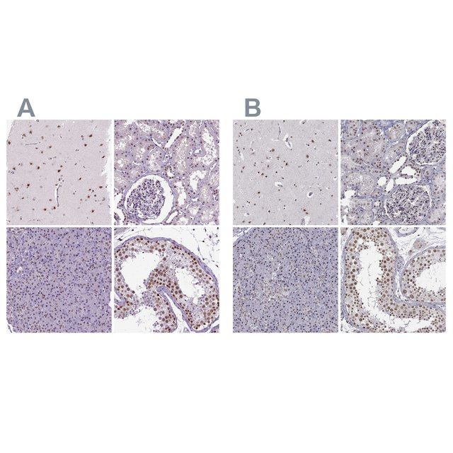 Anti-SETD1A antibody produced in rabbit