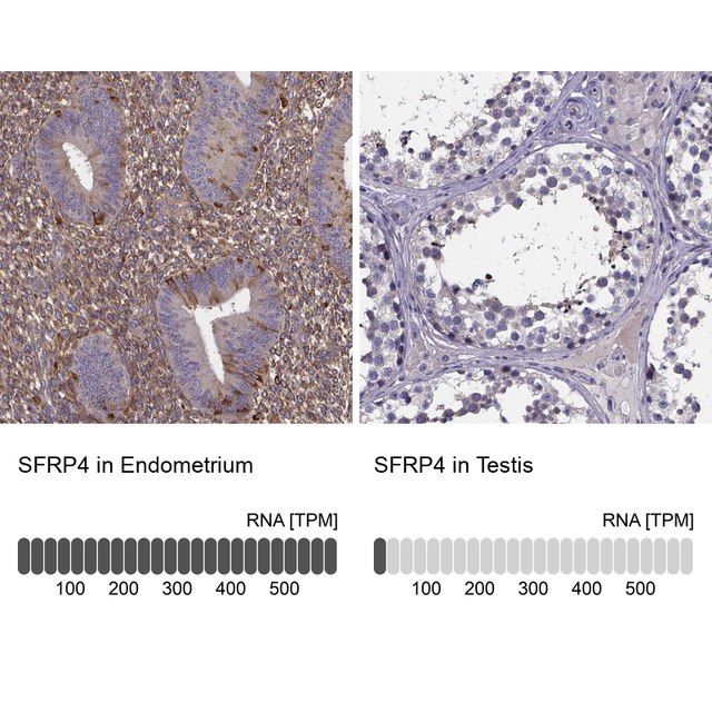 Anti-SFRP4 antibody produced in rabbit