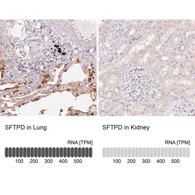 Anti-SFTPD antibody produced in rabbit