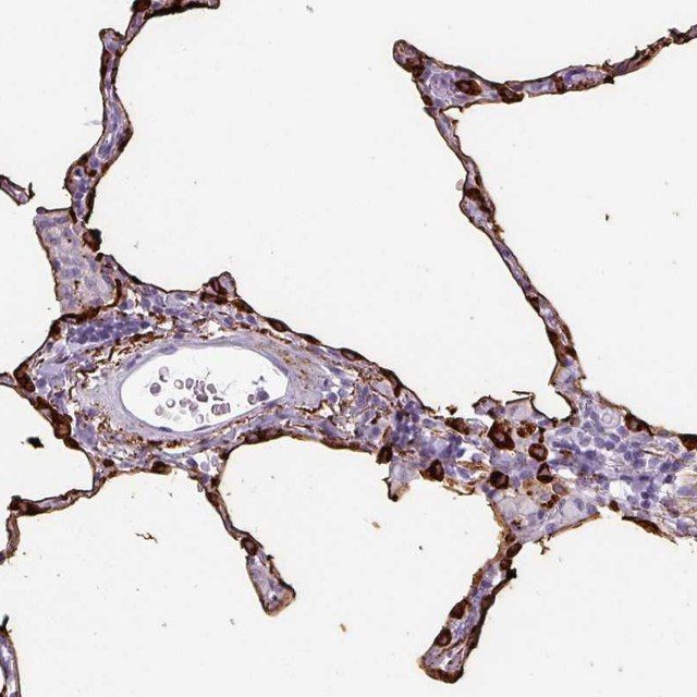 Anti-SFTPA1 antibody produced in rabbit