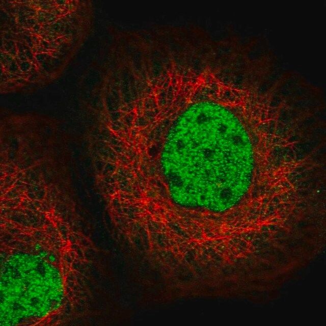 Anti-SFMBT1 antibody produced in rabbit