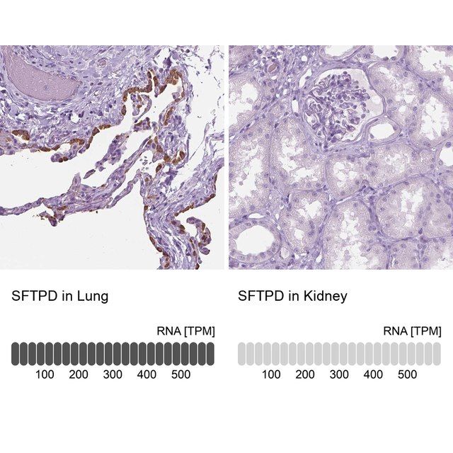 Anti-SFTPD antibody produced in rabbit