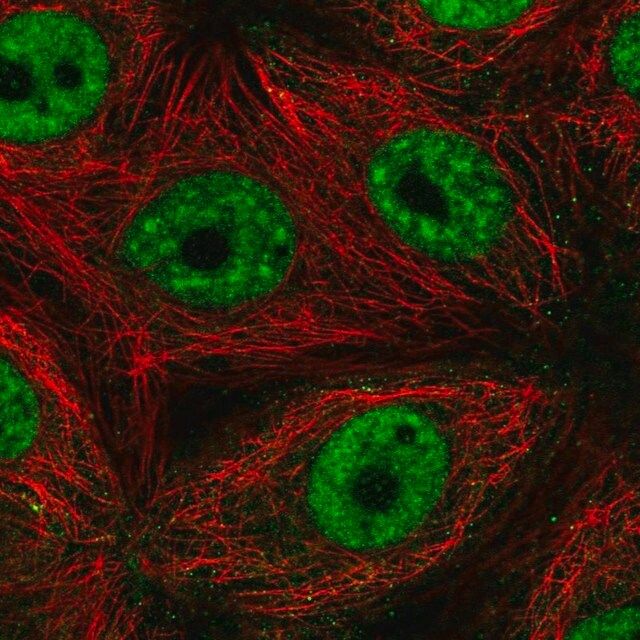 Anti-SF3B4 antibody produced in rabbit