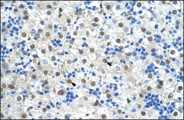 Anti-SF3B1 antibody produced in rabbit