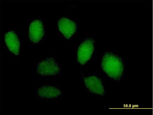 Anti-SFMBT1 antibody produced in mouse