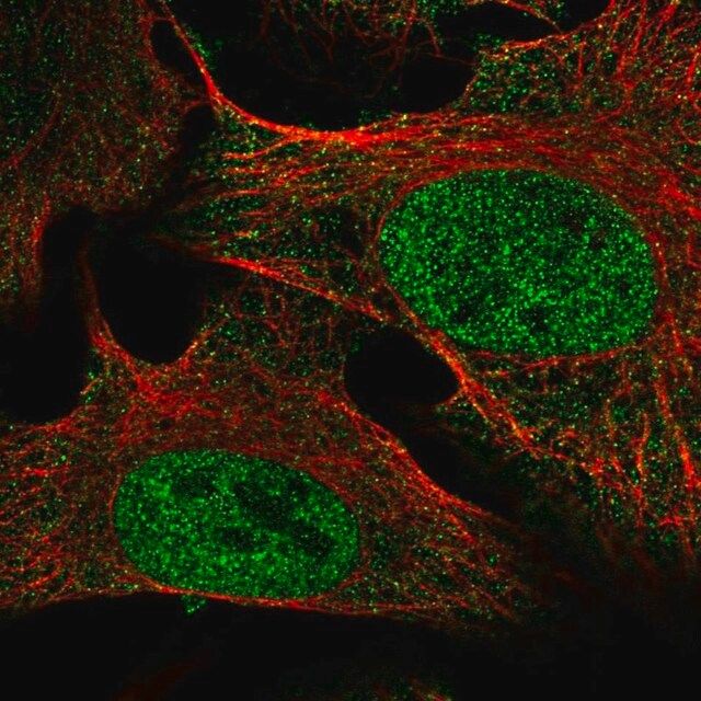 Anti-SETDB2 antibody produced in rabbit