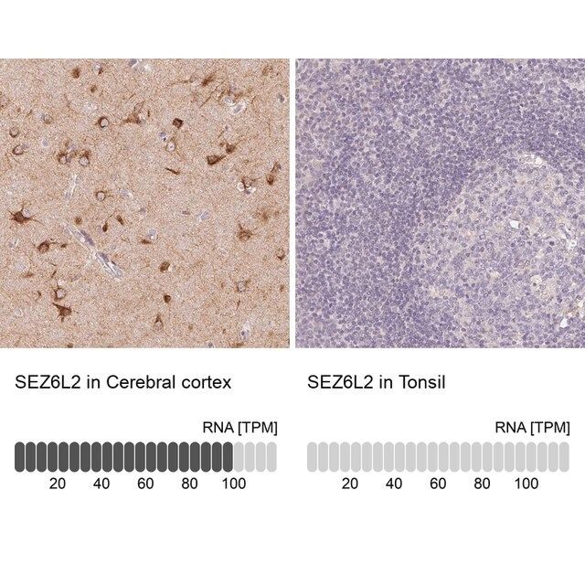 Anti-SEZ6L2 antibody produced in rabbit