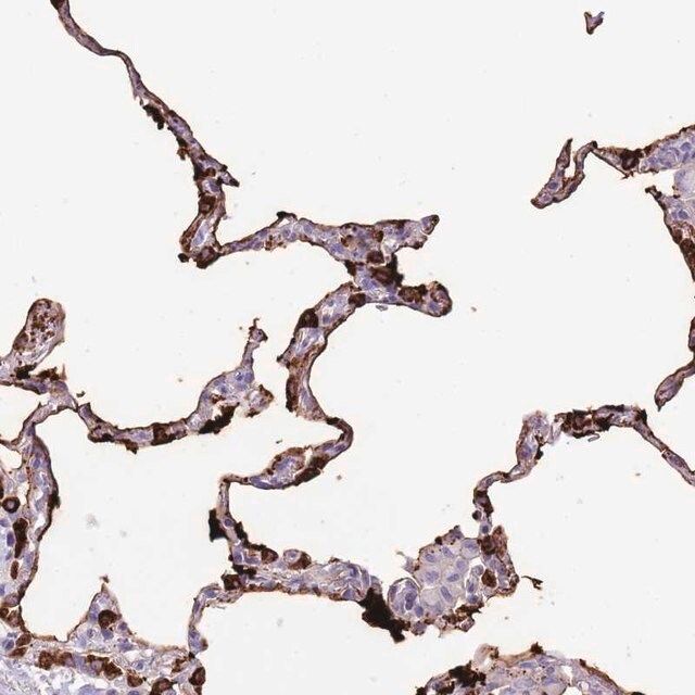 Anti-SFTPA1 antibody produced in rabbit