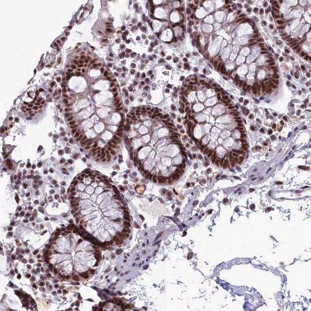 Anti-SF3B3 antibody produced in rabbit