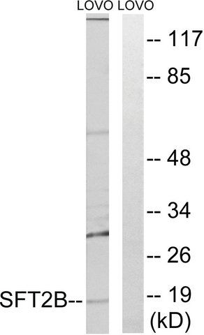 Anti-SFT2B antibody produced in rabbit