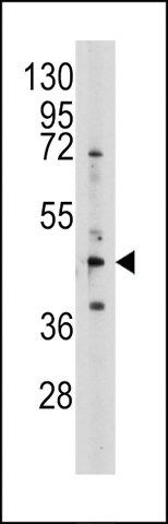 ANTI-S ADENOSYLHOMOCYSTEINE HYDROLASE (ACHY)(N-TERMINAL) antibody produced in rabbit