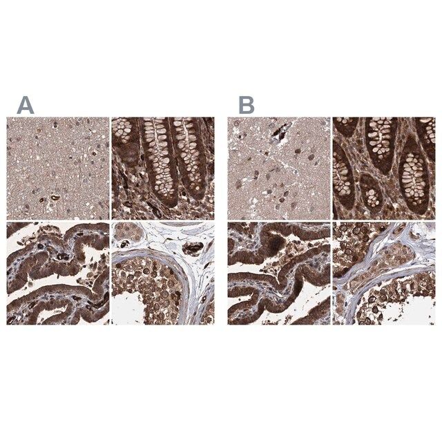 Anti-RPAP3 antibody produced in rabbit